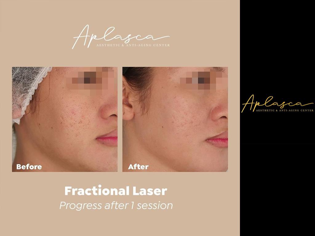 Aplasca Aesthetic and Anti-Aging Center